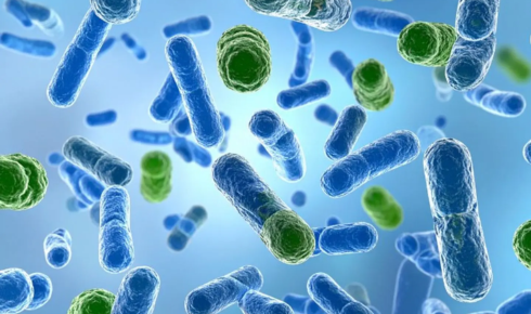 UV disinfection